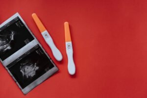 TO CONCEIVE FOLLOWING A SILL-BORN BABY TO CONCEIVE FOLLOWING A SILL-BORN BABY
